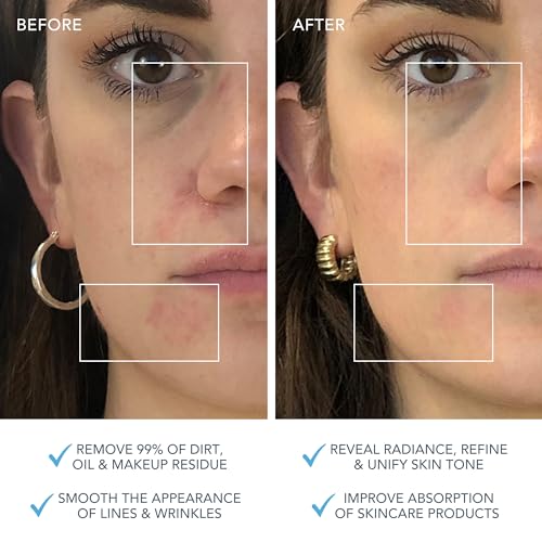 FOREO LUNA 3 Facial Cleansing Brush - Combo Skin