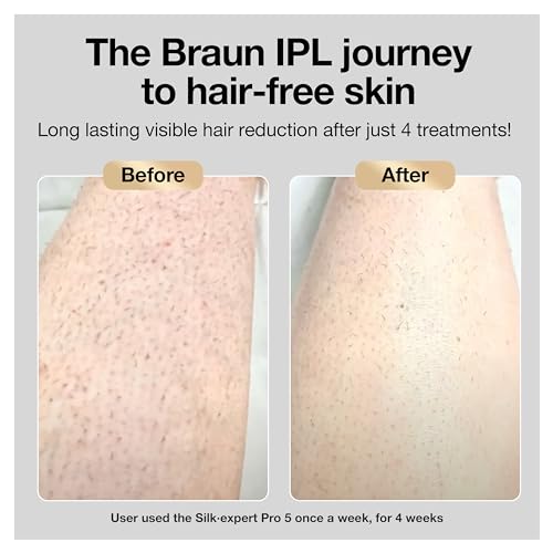 Braun IPL Hair Removal Device: Silk Expert Pro5