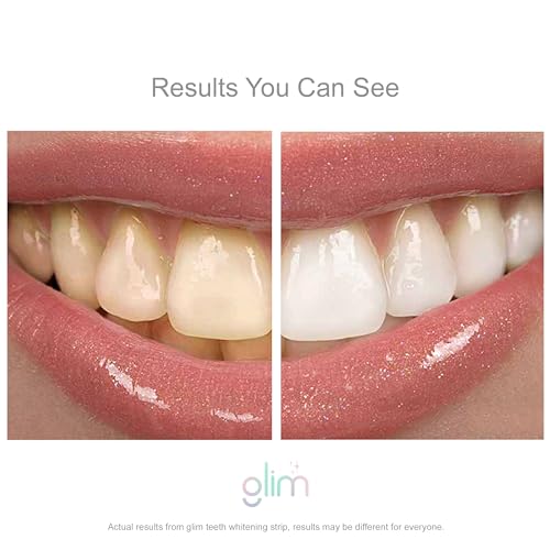 Glim Professional Teeth Whitening Strips - Vegan, Cruelty-Free