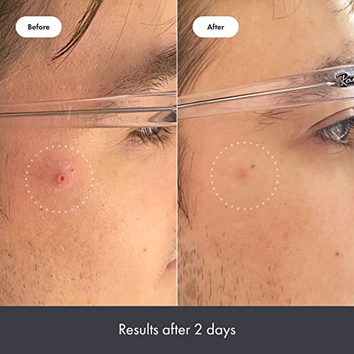Hero Cosmetics Rescue Balm - Intensive Skin Recovery