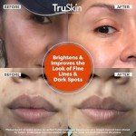 TruSkin Vitamin C Face Serum - Brightening Anti-Aging