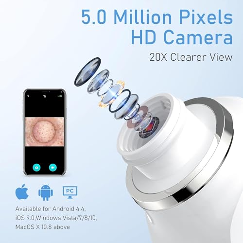 Camera Pore Vacuum with 6 Suction Heads