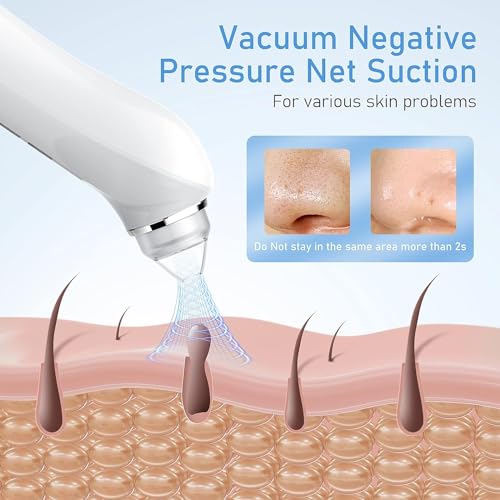 Camera Pore Vacuum with 6 Suction Heads
