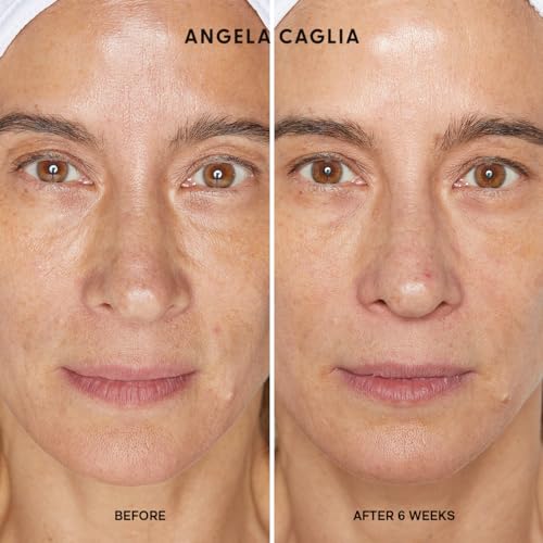 Angela Caglia Cell Forte Serum for Fine Lines