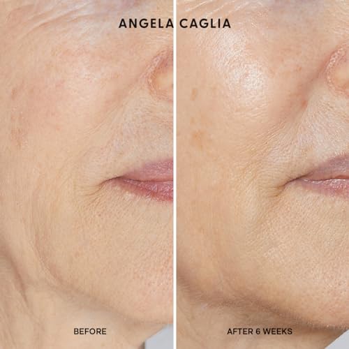 Angela Caglia Cell Forte Serum for Fine Lines