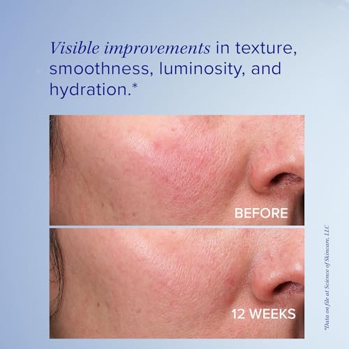 iS Clinical Retinol Emulsion 0.3, minimize lines and wrinkles