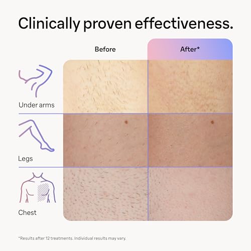 Braun IPL Laser Hair Removal Device for Women & Men