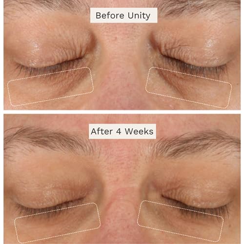 Unity Age Reversal Eye Serum with Retinol+