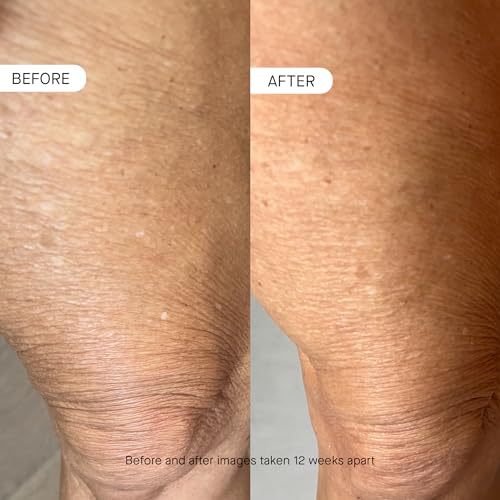 OneSkin BODY OS-01 Peptide Skin Reversal Moisturizer