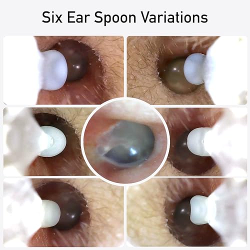 Wireless Otoscope with LED Light - Ear Care Kit