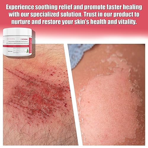 Organic Manuka Honey Healing Relief Care Products-Limited Ed