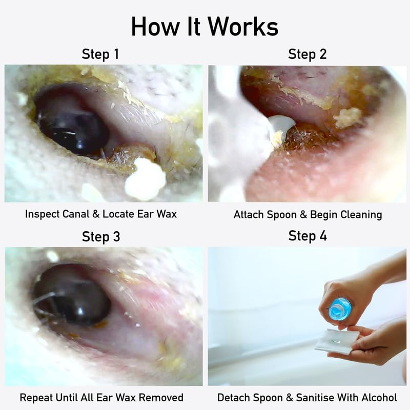 Wireless Otoscope with LED Light - Ear Care Kit