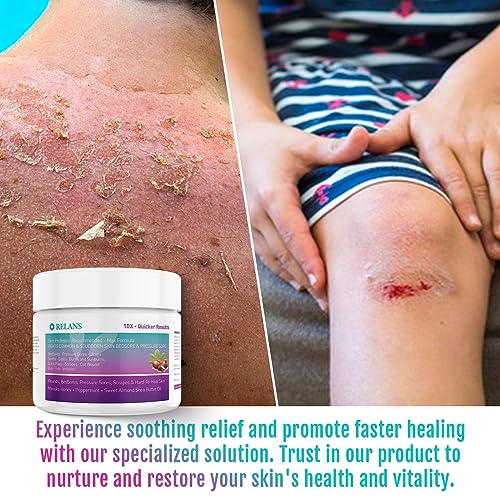 Manuka Honey Healing Cream for Bed Sores & Wounds