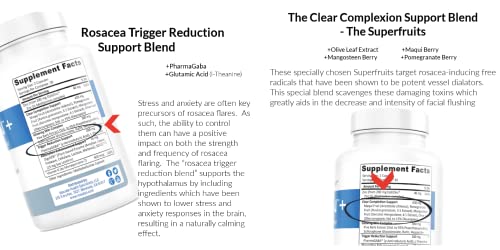 Rosadyn Rosacea Skin Care Set: Redness Relief Trio