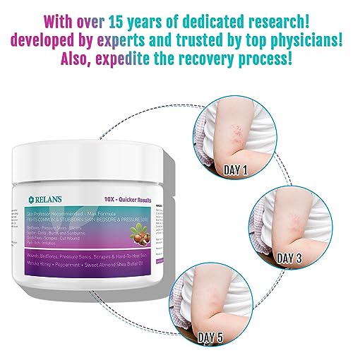 Manuka Honey Healing Cream for Bed Sores & Wounds