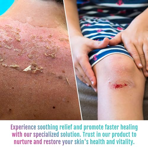 5x Faster Healing Manuka Honey Butt Cream for Sores