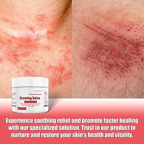 Organic Manuka Honey Healing Cream for Bed Sores