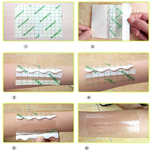 PICC Pipe Cover for Peritoneal Dialysis Patients
