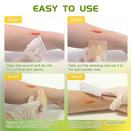 Manuka Honey Gauze Dressing for Wound Care