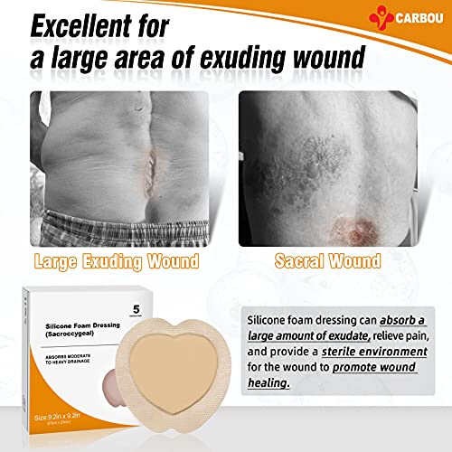 Carbou Silicone Sacral Foam Dressing, 9''x9'' Box of 5