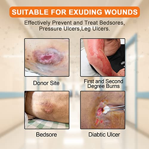 Carbou Silicone Sacral Foam Dressing, 9''x9'' Box of 5