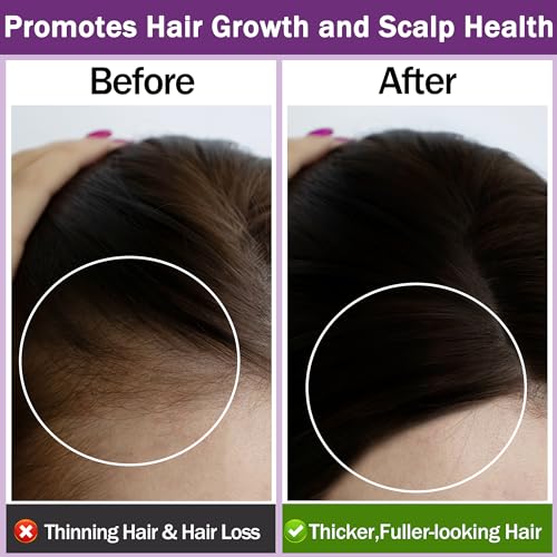 100% Pure Rosemary Hair Growth Oil with Roller