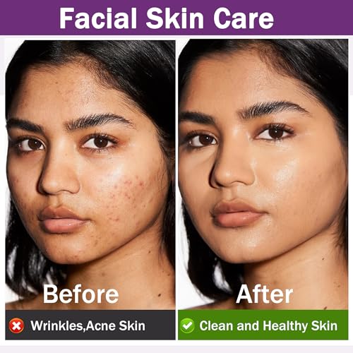 100% Pure Rosemary Hair Growth Oil with Roller