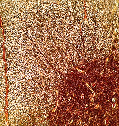 iPhone Xs Max LabCam Microscope Adapter VIP Shop