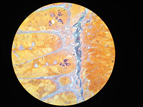 iPhone Xs Max LabCam Microscope Adapter VIP Shop