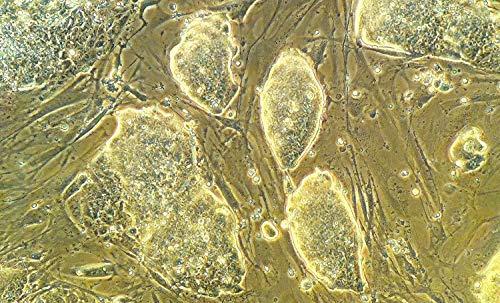 iPhone Xs Max LabCam Microscope Adapter VIP Shop