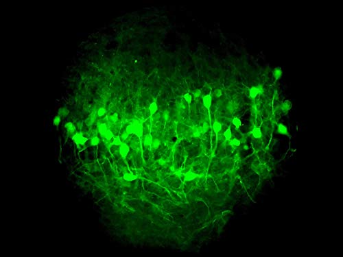 iPhone Xs Max LabCam Microscope Adapter VIP Shop