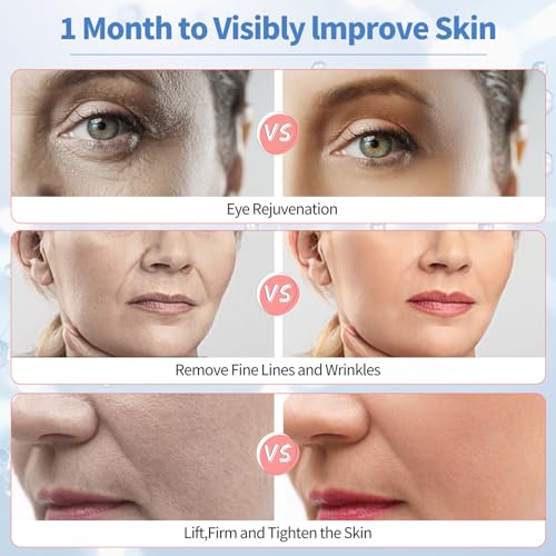 Texet Microcurrent Facial Massager for Face Neck Eyes