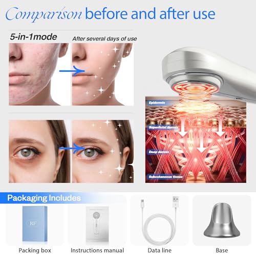 Lux Reyan Facial Device: 6-in-1 Skin Tightening Machine