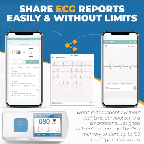 Fast Portable ECG Monitor: Measure in 30 Seconds!