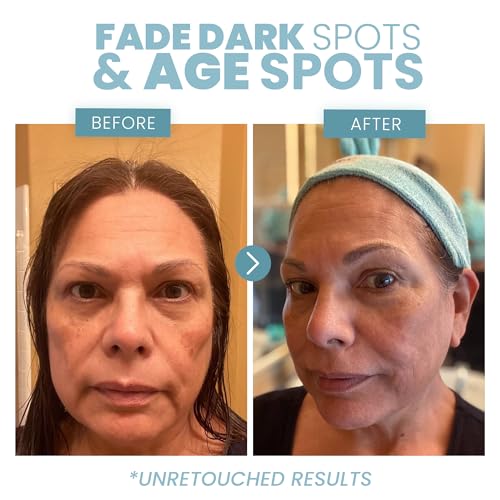 Powerful 20% Vitamin C Serum for VIP Skin