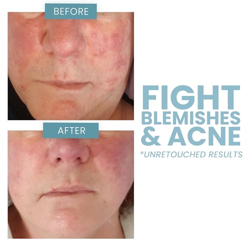 Powerful 20% Vitamin C Serum for VIP Skin