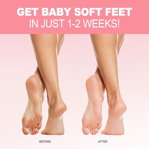 VIP Foot Peel Mask - Repair Cracked Heels, Smoother Skin