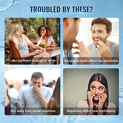 Whitebite Pro Teeth Whitening Kit with LED Light