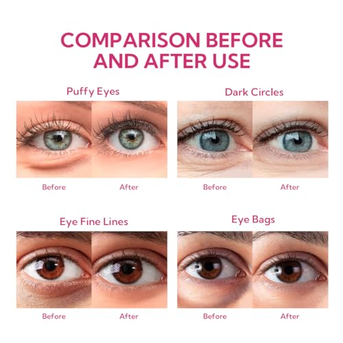 BREYLEE Rose Eye Mask - 60 Pcs - Hydrating and Firming VIP Eye Patches