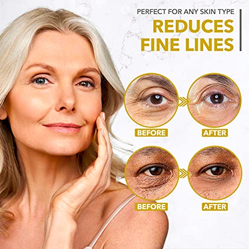 Collagen Eye Patches for Dark Circles and Puffiness