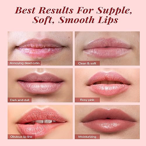 ANAI RUI VIP Lip Care Set