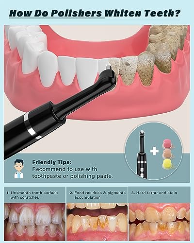 Rechargeable Teeth Whitening Kit - At-Home Dental Care