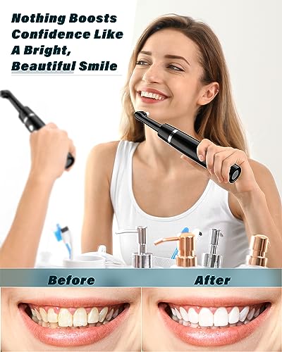 Rechargeable Teeth Whitening Kit - At-Home Dental Care