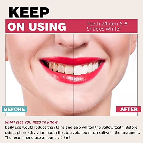 Fast and Effective Teeth Whitening System