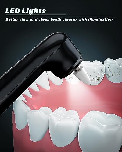 Rechargeable Teeth Whitening Kit - At-Home Dental Care