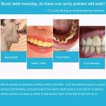 Fencia Electric Tooth Polisher with 4 Heads