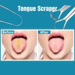 Stainless Steel Tongue Scrapers - 3 Pack