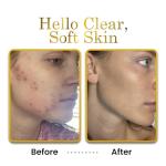 Luxe Hyaluronic Acid Moisturizer - Vanilla Scent