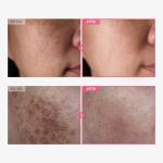 Brightening Cream with Arbutin and Tranexamic Acid