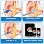 Ear Wax Removal Kit with 1080HD Camera